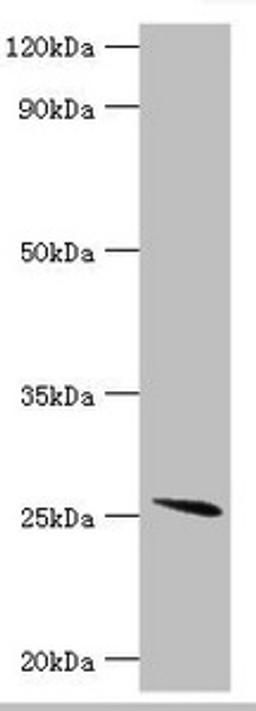 Western blot. All lanes: Glutathione S-transferase A2 antibody at 4ug/ml + Mouse liver tissue. Secondary. Goat polyclonal to rabbit IgG at 1/10000 dilution. Predicted band size: 26 kDa. Observed band size: 26 kDa. 