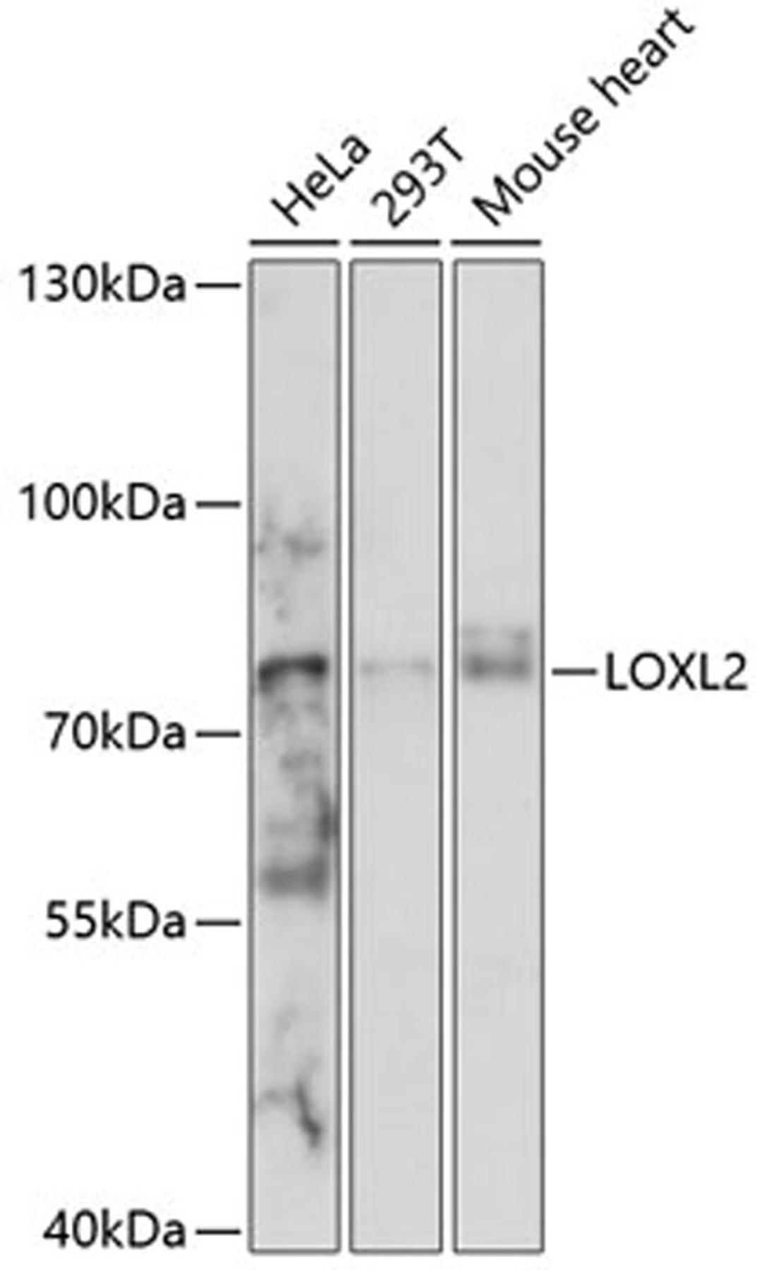 Western blot - LOXL2 antibody (A14638)