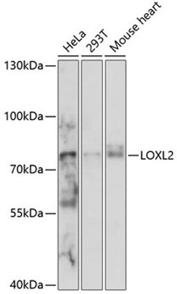 Western blot - LOXL2 antibody (A14638)