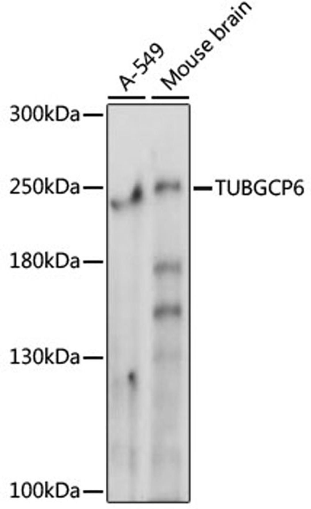 Western blot - TUBGCP6 antibody (A15921)