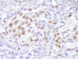 Detection of human EDD1 by immunohistochemistry.