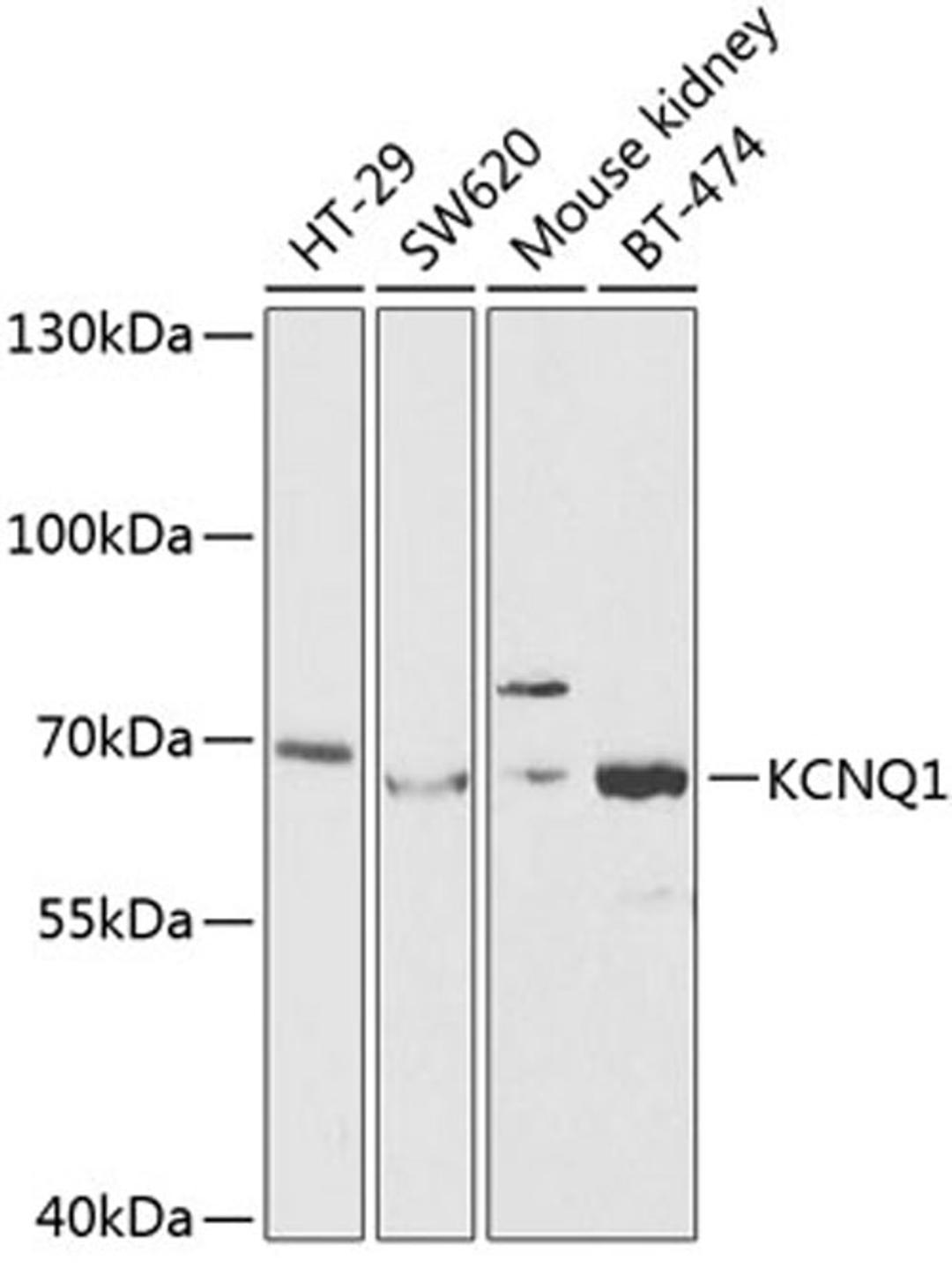 Western blot - KCNQ1 antibody (A2174)