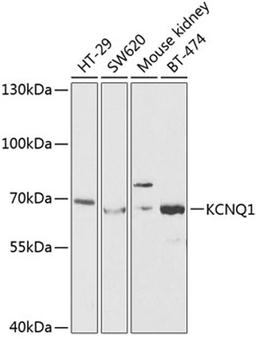 Western blot - KCNQ1 antibody (A2174)