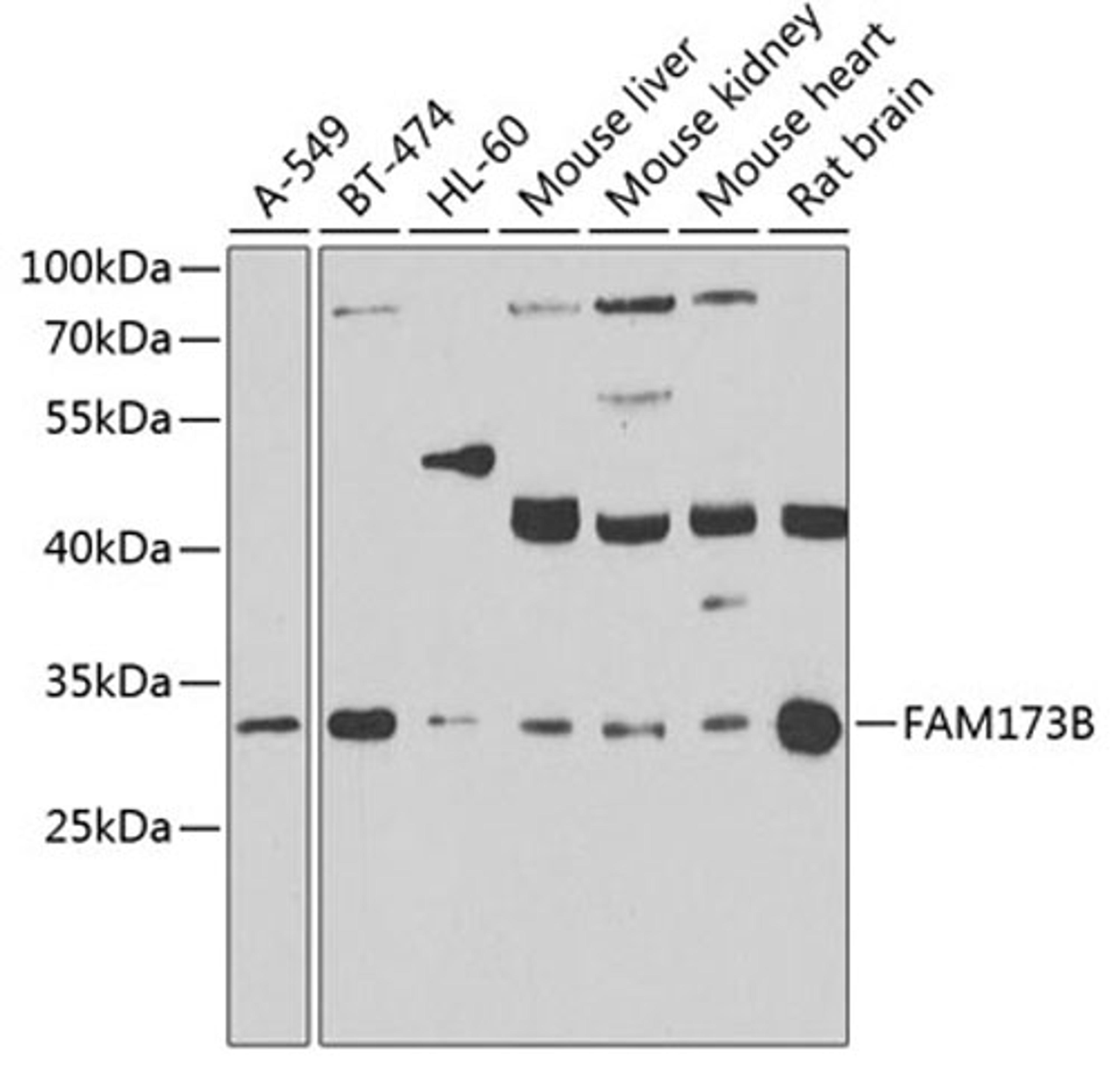 Western blot - FAM173B antibody (A7403)