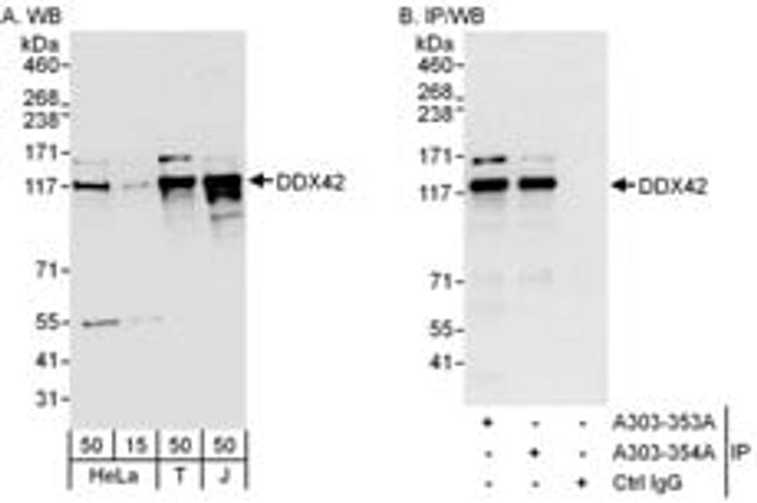 Detection of human DDX42 by western blot and immunoprecipitation.