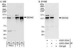 Detection of human DDX42 by western blot and immunoprecipitation.