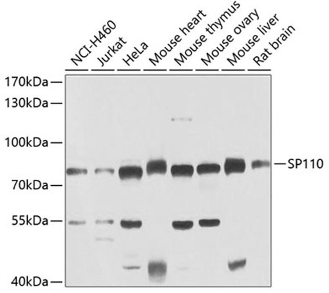 Western blot - SP110 antibody (A7492)