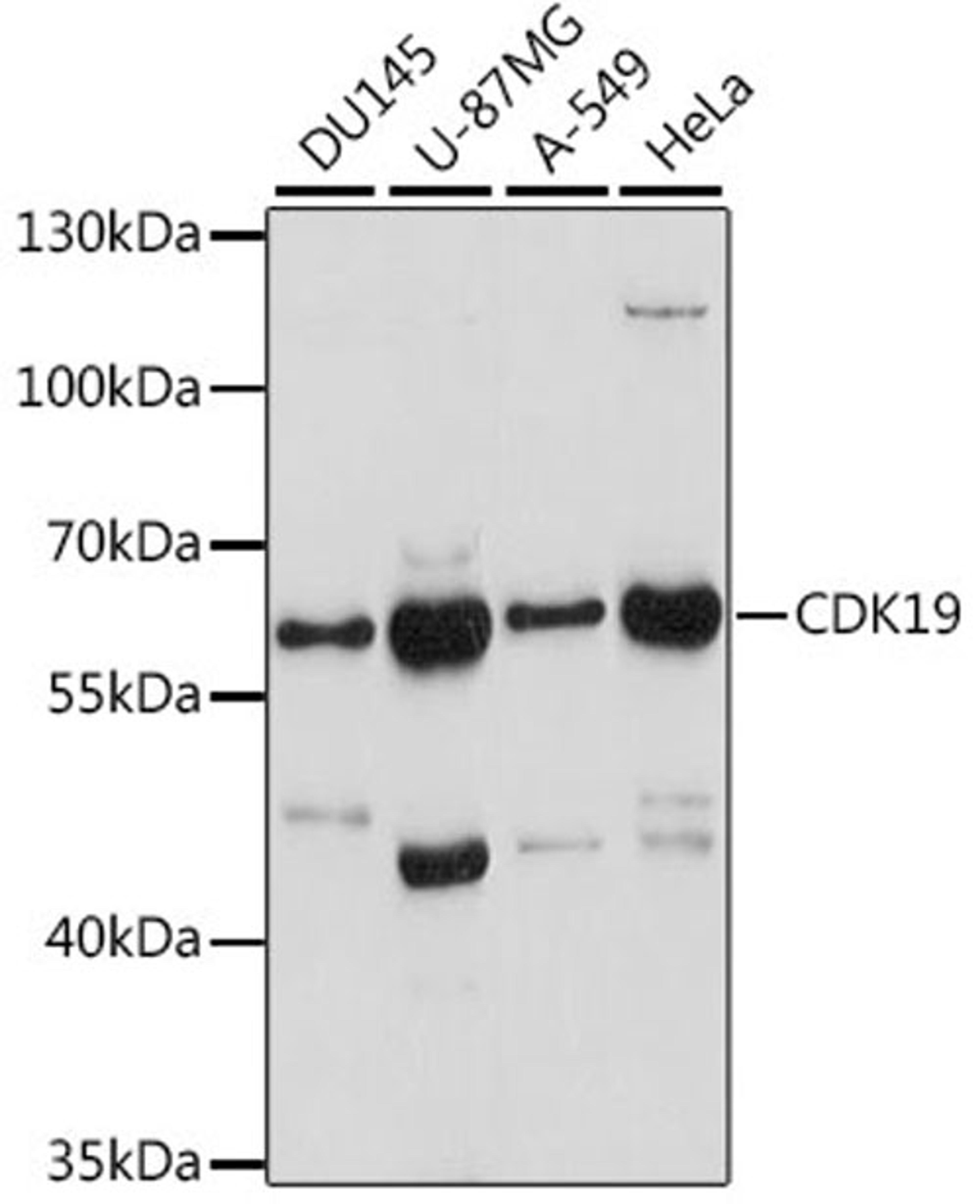 Western blot - CDK19 antibody (A16109)