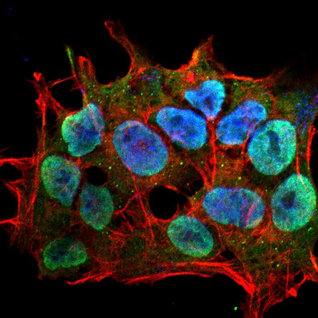 Immunofluorescence analysis of neuroblastoma cell line sk-n-be using SHANK1 antibody