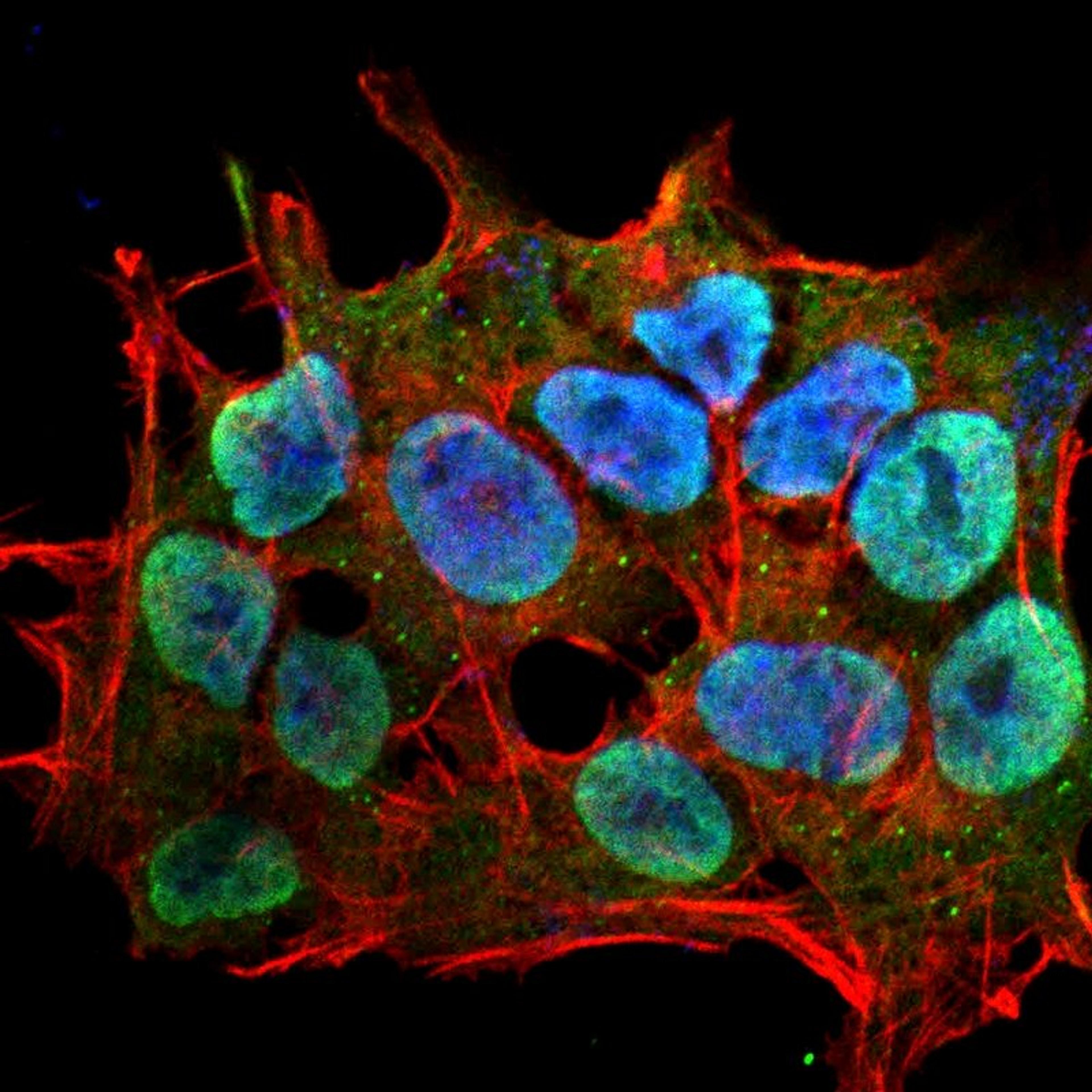 Immunofluorescence analysis of neuroblastoma cell line sk-n-be using SHANK1 antibody