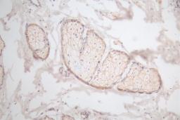 IHC image of CSB-RA945763A0HU diluted at 1:100 and staining in paraffin-embedded human skin tissue performed on a Leica BondTM system. After dewaxing and hydration, antigen retrieval was mediated by high pressure in a citrate buffer (pH 6.0). Section was blocked with 10% normal goat serum 30min at RT. Then primary antibody (1% BSA) was incubated at 4°C overnight. The primary is detected by a Goat anti-rabbit polymer IgG labeled by HRP and visualized using 0.66% DAB.