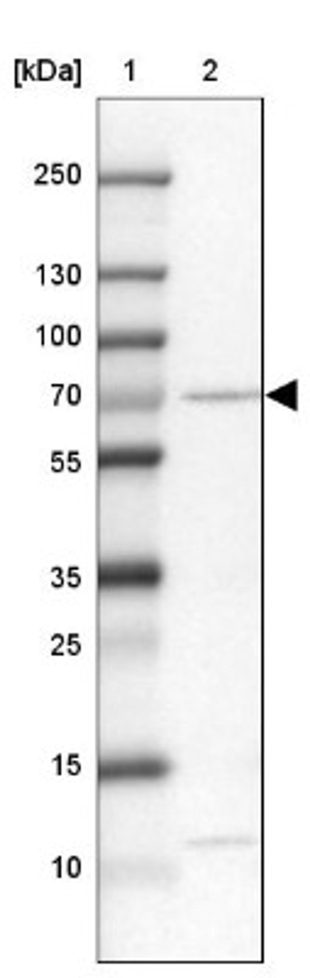 Western Blot: CYP4V2 Antibody [NBP1-85361] - Lane 1: Marker [kDa] 250, 130, 100, 70, 55, 35, 25, 15, 10<br/>Lane 2: SK-MEL-30