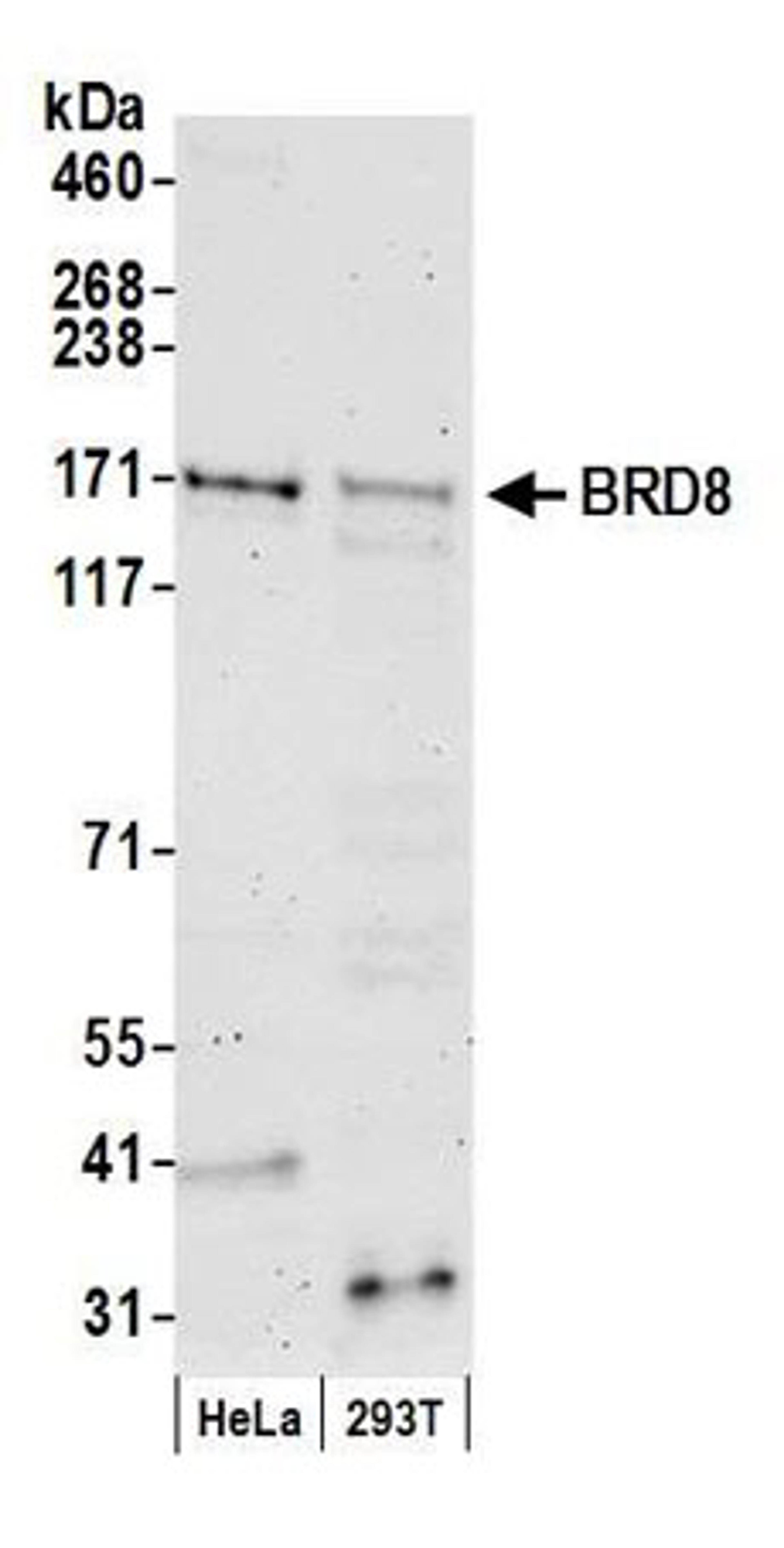 Detection of human BRD8 by western blot.