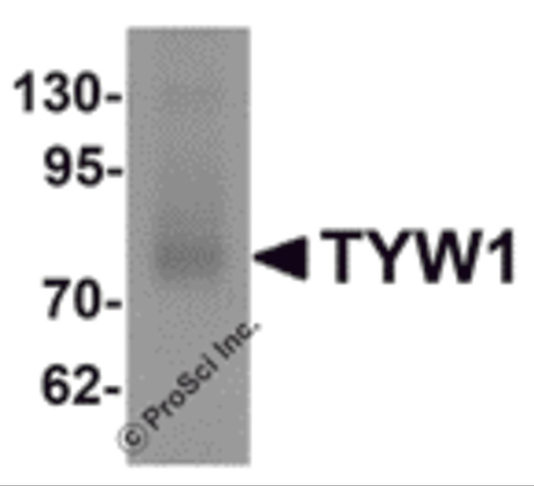 Western blot analysis of TYW1 in human lung tissue lysate with TYW1 antibody at 1 μg/mL.