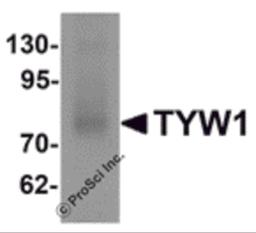 Western blot analysis of TYW1 in human lung tissue lysate with TYW1 antibody at 1 μg/mL.