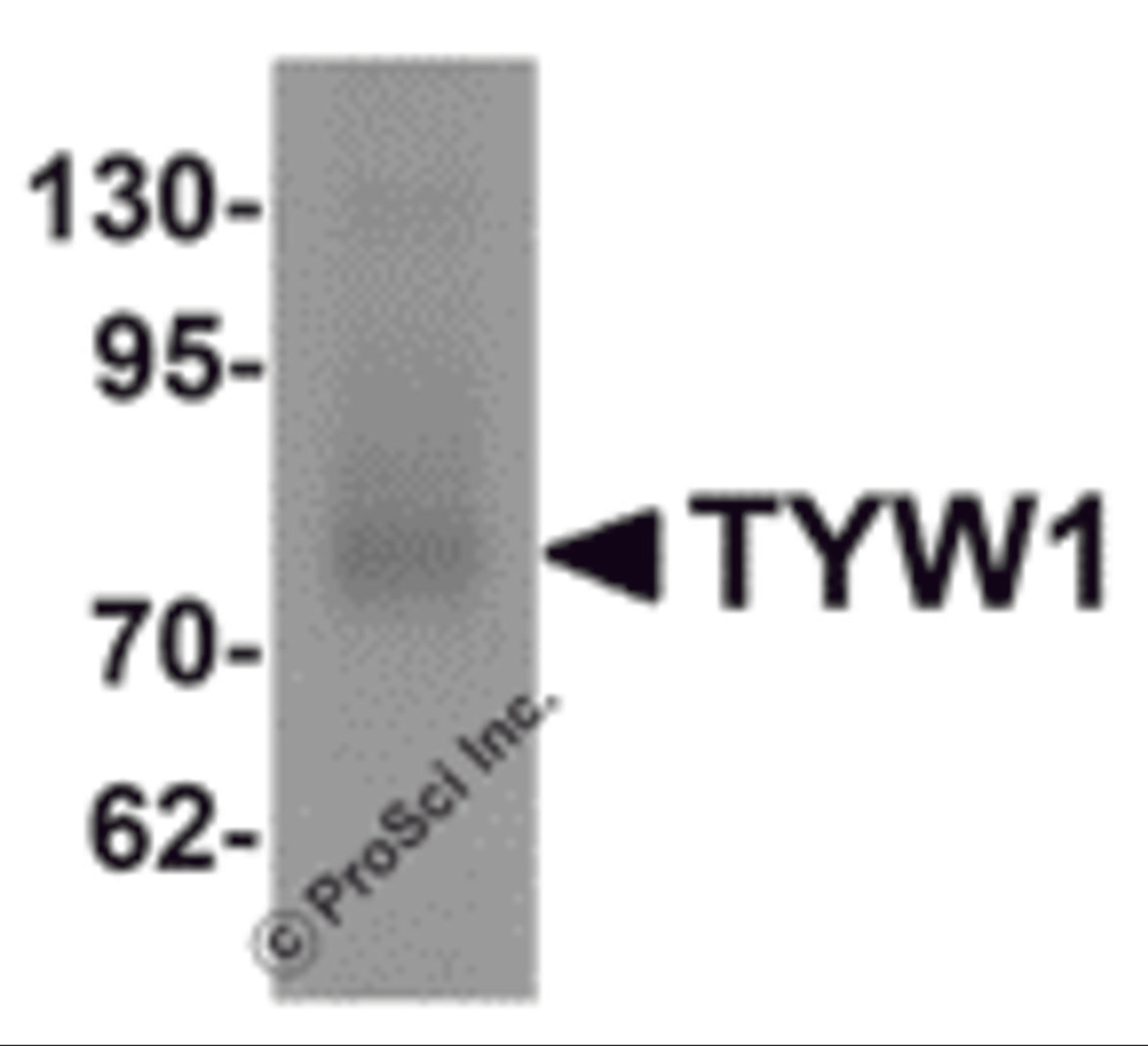 Western blot analysis of TYW1 in human lung tissue lysate with TYW1 antibody at 1 μg/mL.