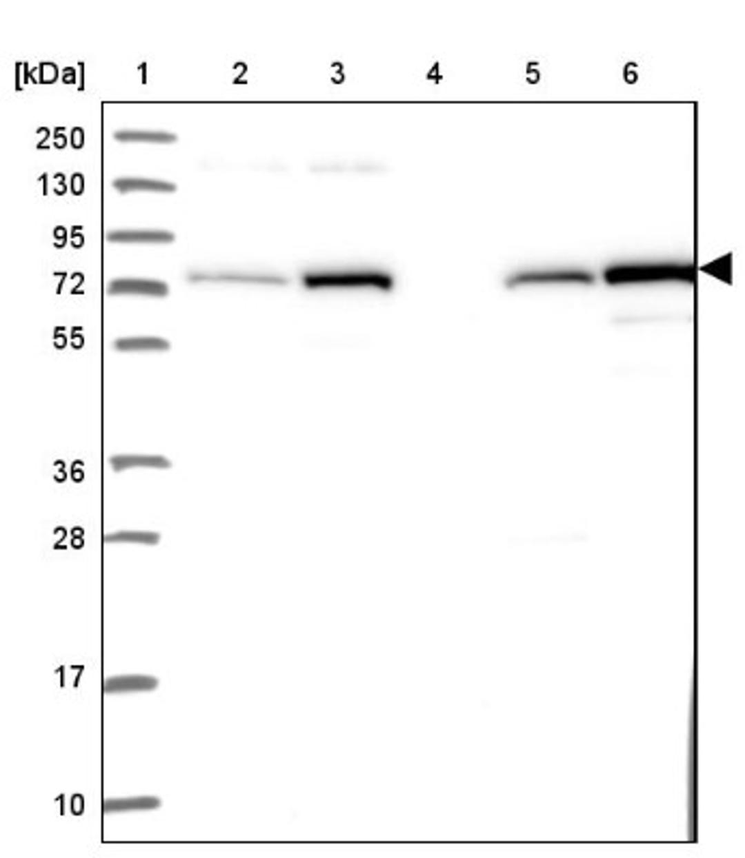 Western Blot: Phospholipase D1 Antibody [NBP2-34078] - Lane 1: Marker [kDa] 250, 130, 95, 72, 55, 36, 28, 17, 10<br/>Lane 2: Human cell line RT-4<br/>Lane 3: Human cell line U-251MG sp<br/>Lane 4: Human plasma (IgG/HSA depleted)<br/>Lane 5: Human liver tissue<br/>Lane 6: Human tonsil tissue