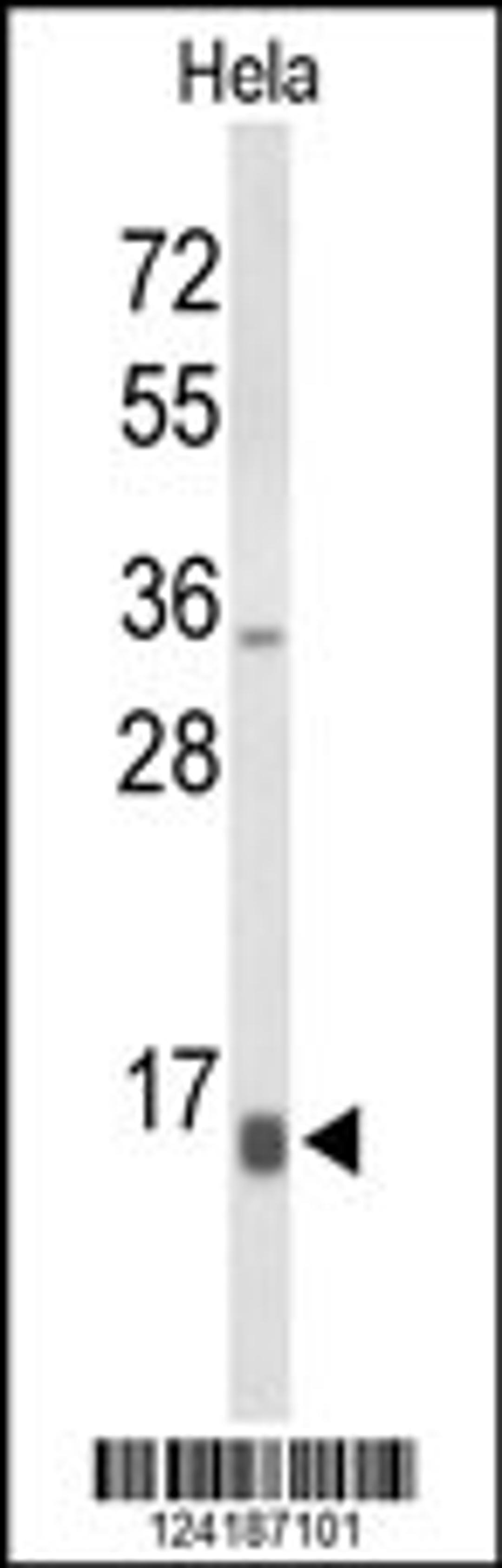 Western blot analysis of NPW Antibody in Hela cell line lysates (35ug/lane)