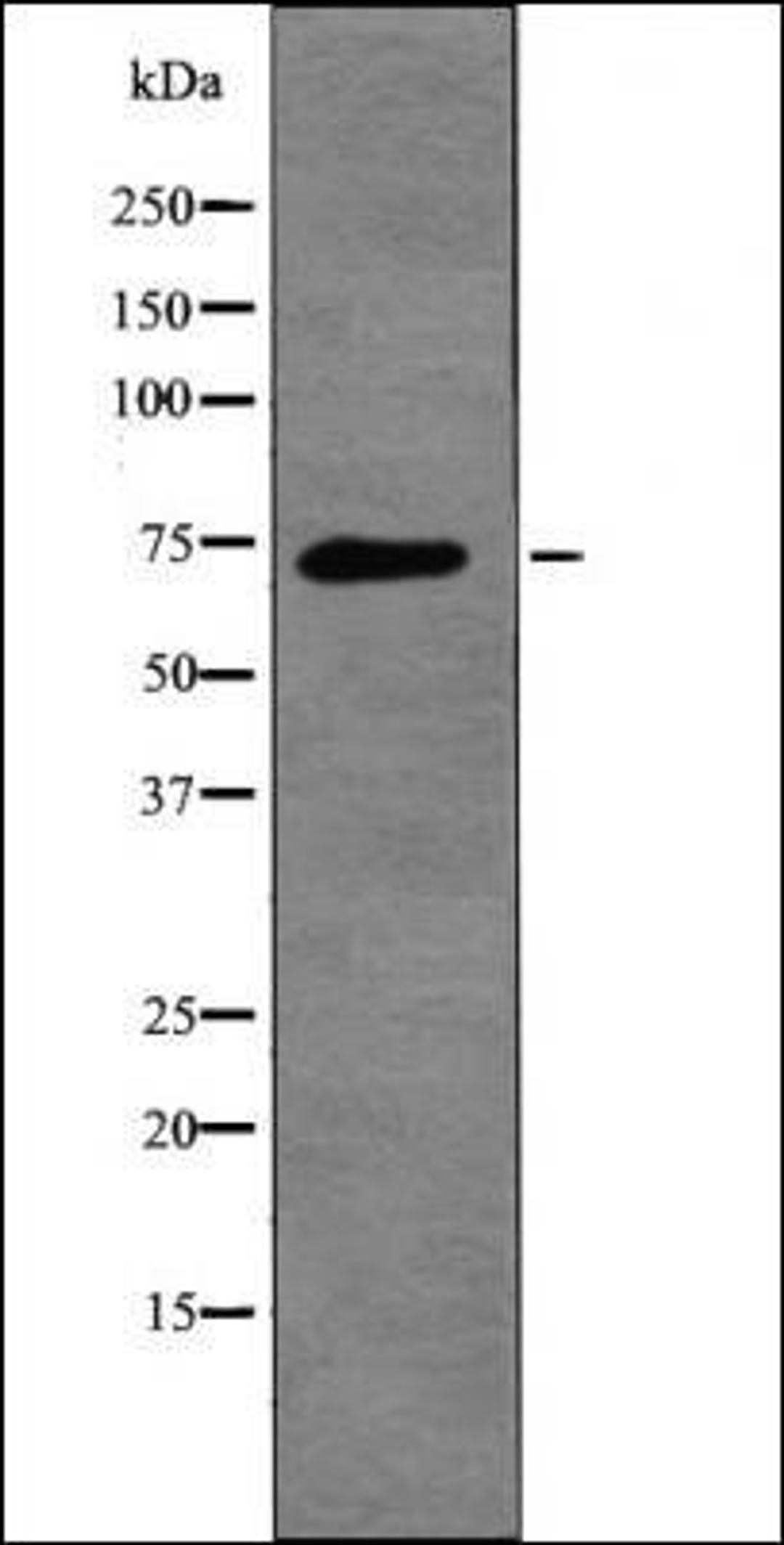 Western blot analysis of 293 whole cell lysates using L-plastin -Phospho-Ser5- antibody