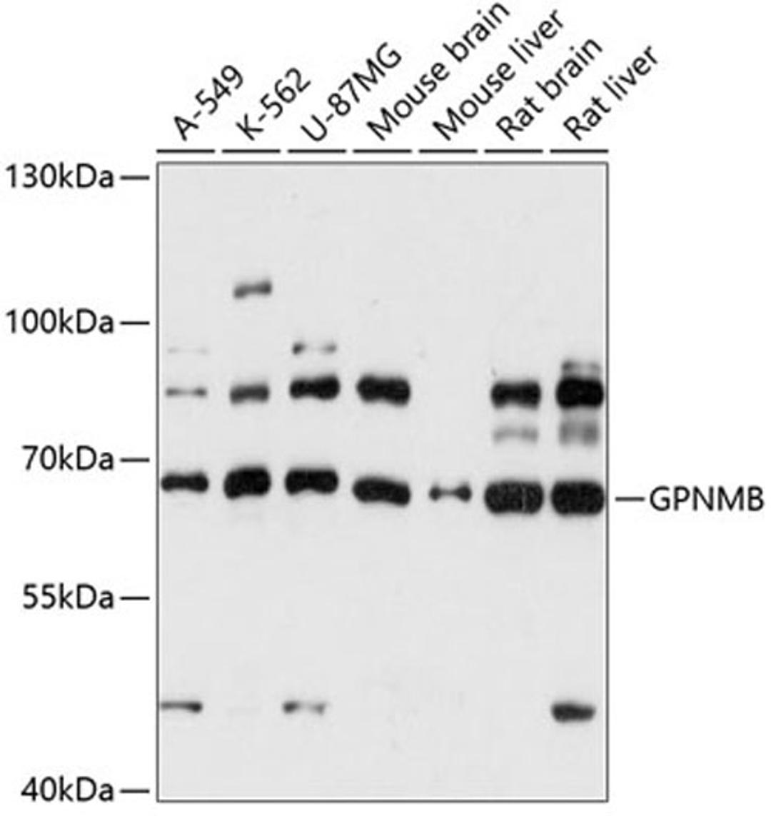 Western blot - GPNMB antibody (A14270)