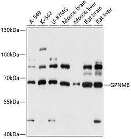 Western blot - GPNMB antibody (A14270)