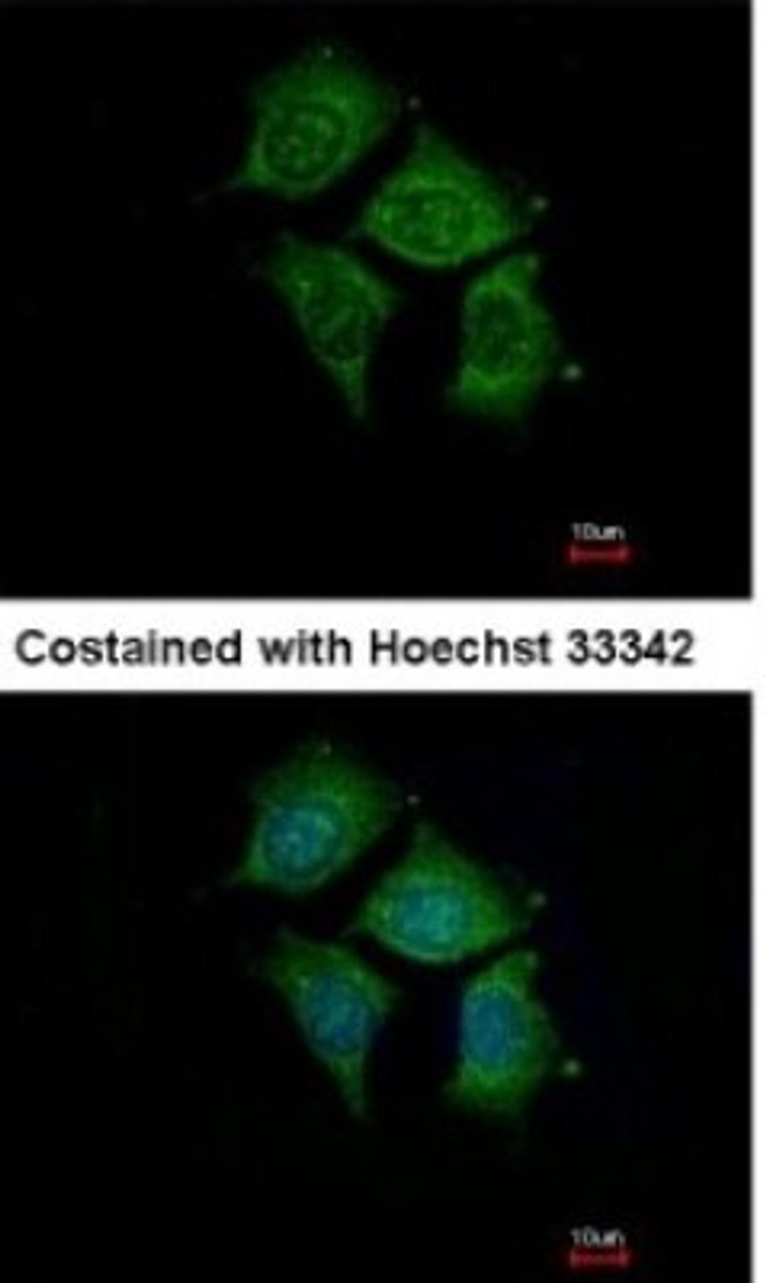 Immunocytochemistry/Immunofluorescence: POMGNT1 Antibody [NBP1-33084] - Analysis of methanol-fixed Hep3B, using antibody at 1:500 dilution.