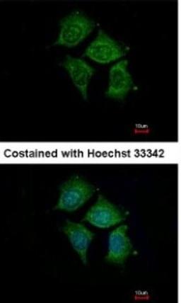 Immunocytochemistry/Immunofluorescence: POMGNT1 Antibody [NBP1-33084] - Analysis of methanol-fixed Hep3B, using antibody at 1:500 dilution.