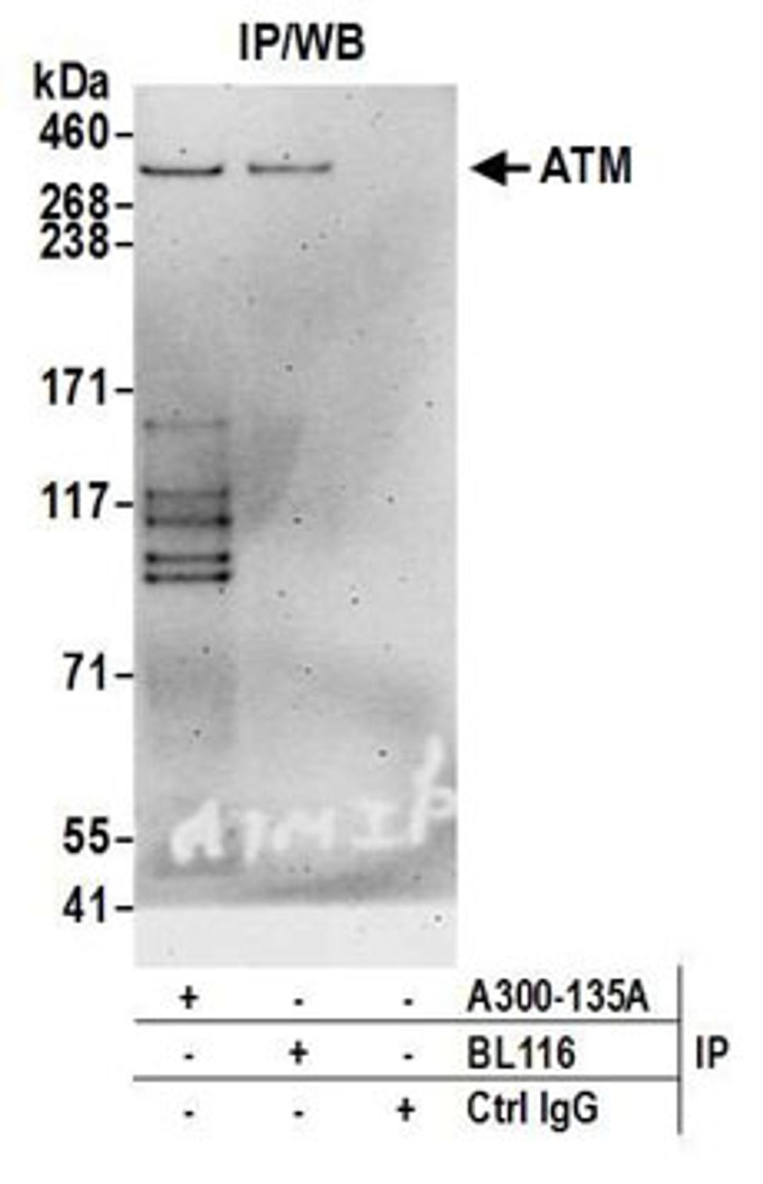 Detection of human ATM by western blot of immunoprecipitates.