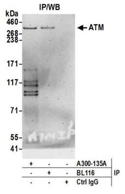 Detection of human ATM by western blot of immunoprecipitates.