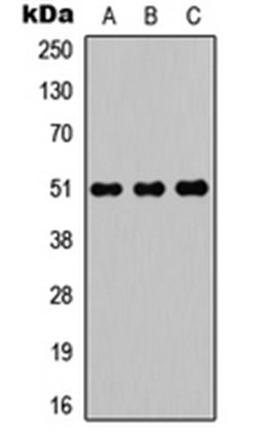 Western blot analysis of HEK293T (Lane 1), Raw264.7 (Lane 2), H9C2 (Lane 3) whole cell lysates using POTEA antibody