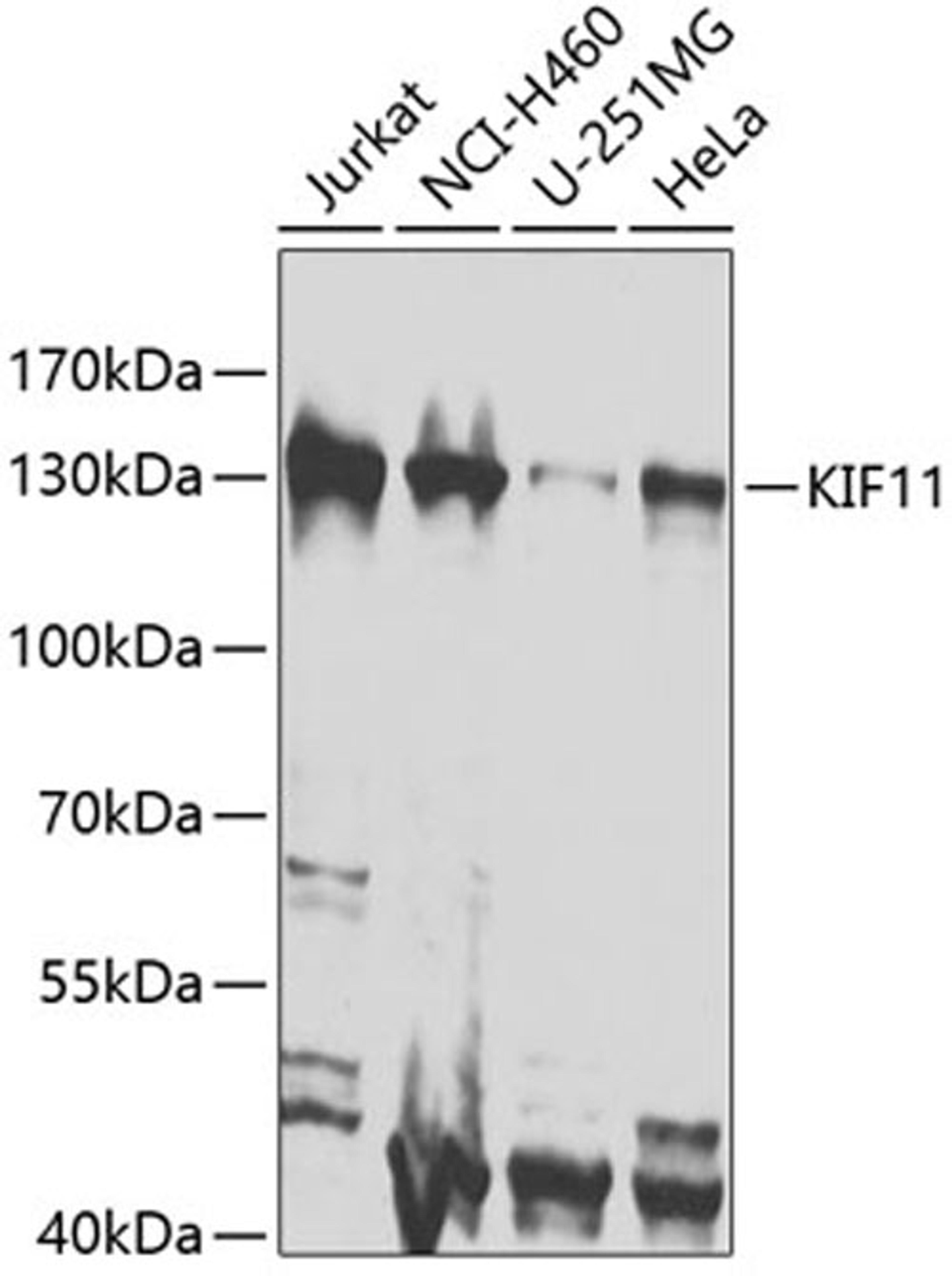 Western blot - KIF11 antibody (A7907)