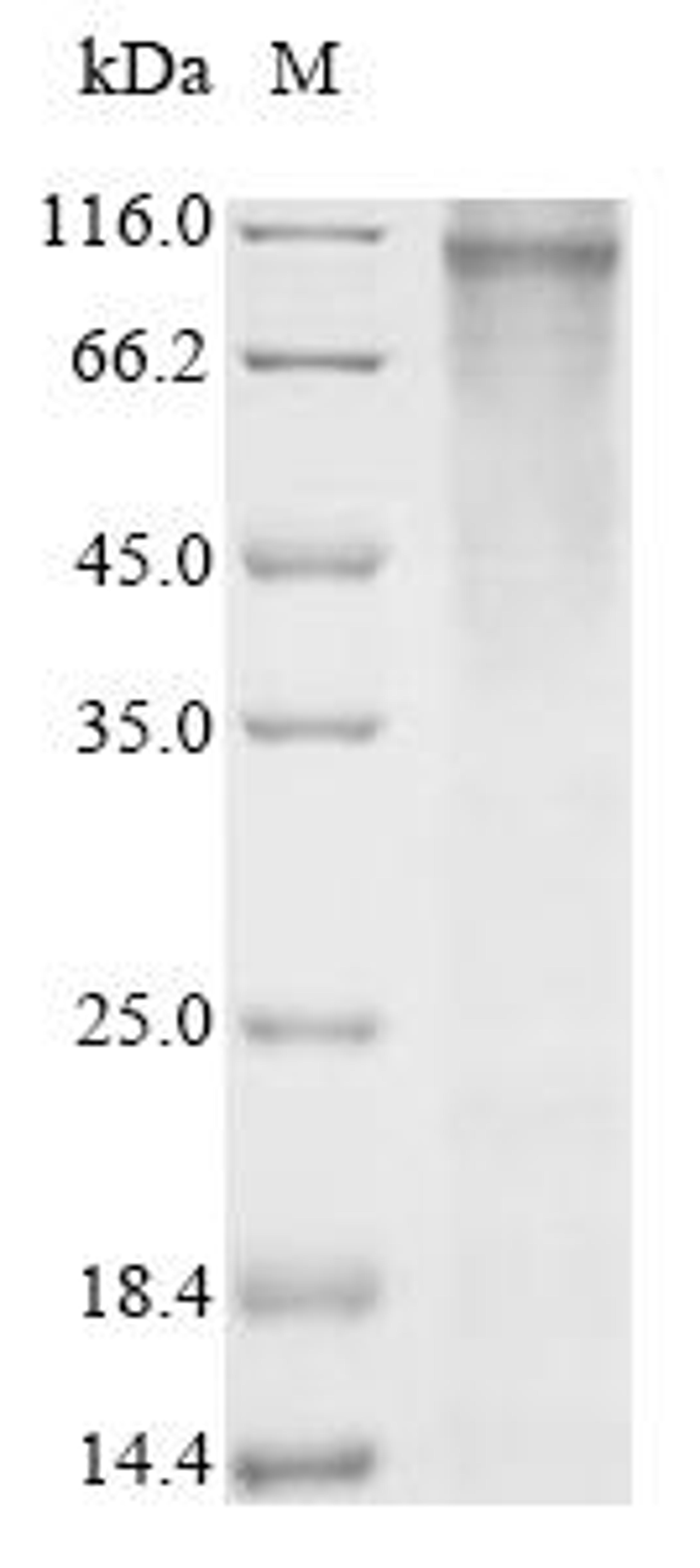 (Tris-Glycine gel) Discontinuous SDS-PAGE (reduced) with 5% enrichment gel and 15% separation gel.