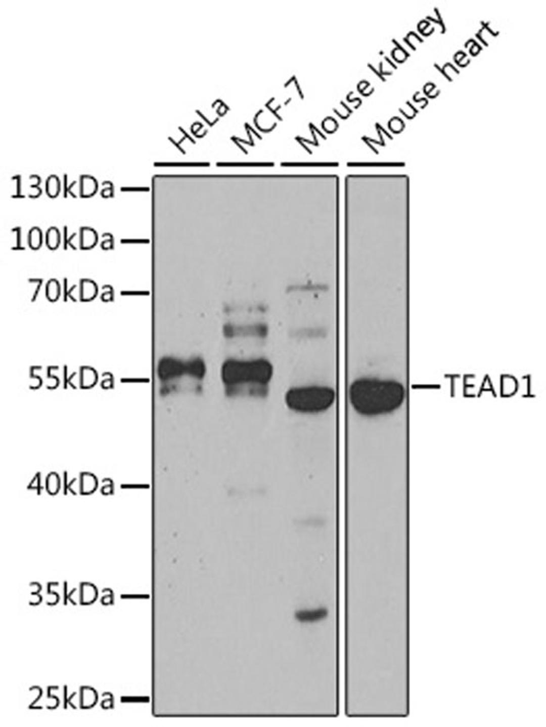 Western blot - TEAD1 antibody (A13366)