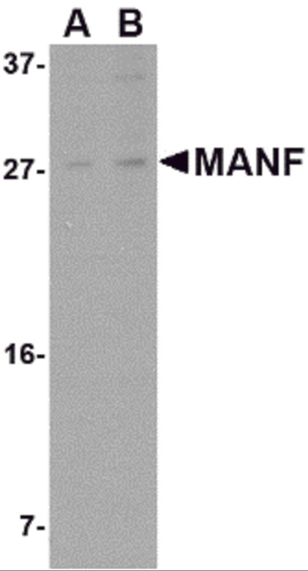 Western blot analysis of MANF in rat brain tissue lysate with MANF antibody at (A) 1 and (B) 2 μg/mL.