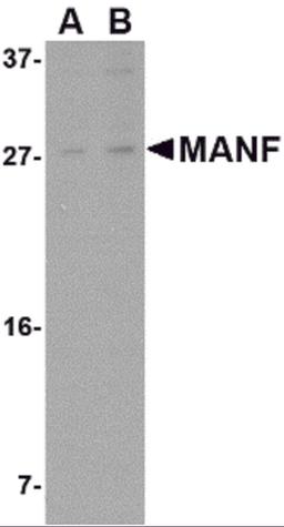 Western blot analysis of MANF in rat brain tissue lysate with MANF antibody at (A) 1 and (B) 2 μg/mL.