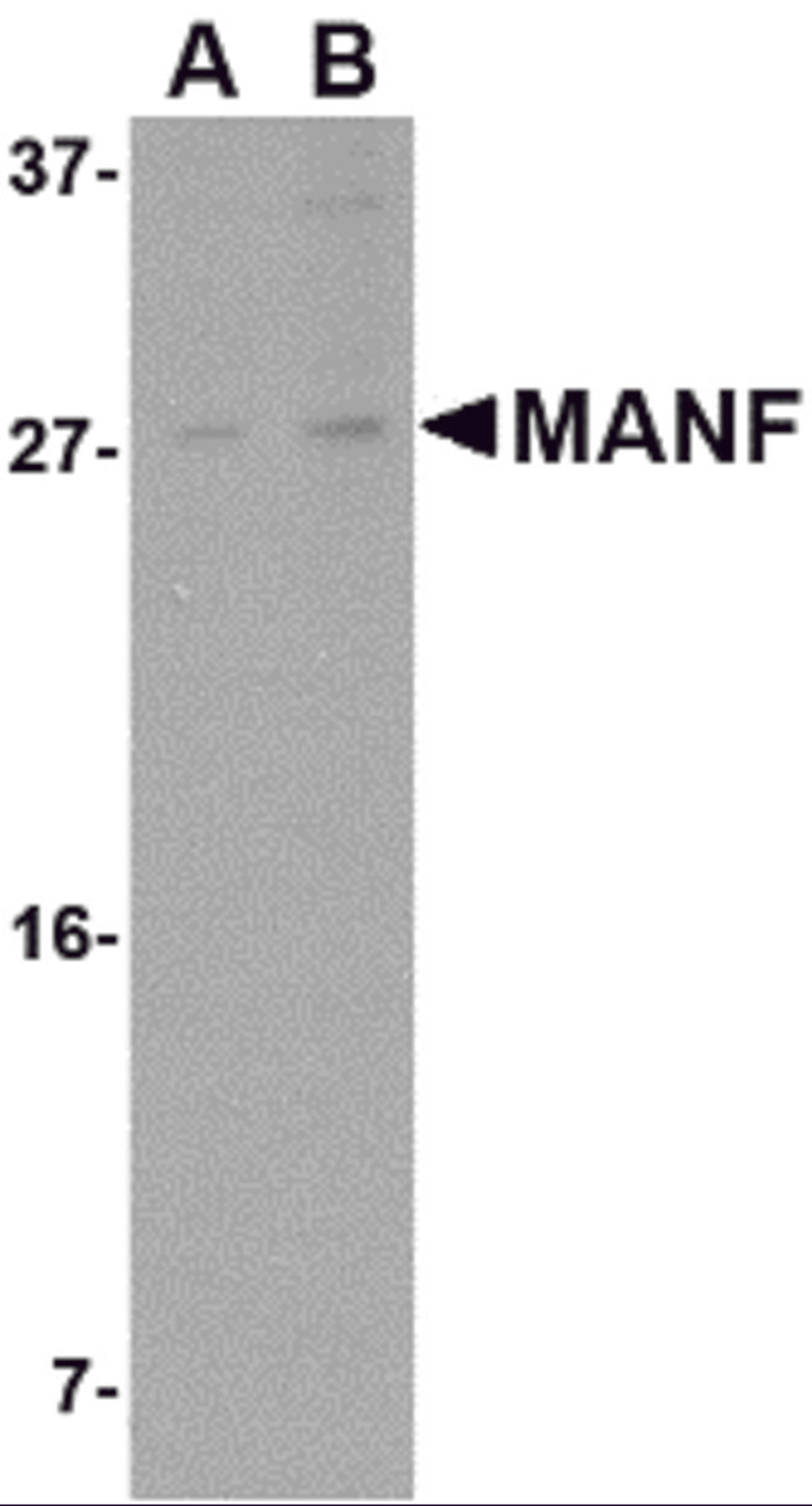 Western blot analysis of MANF in rat brain tissue lysate with MANF antibody at (A) 1 and (B) 2 μg/mL.