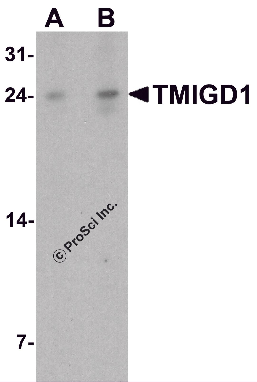Western blot analysis of TMIGD1 in rat liver tissue lysate with TMIGD1 antibody at (A) 1 and (B) 2 μg/ml.