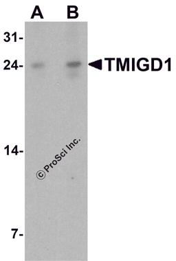 Western blot analysis of TMIGD1 in rat liver tissue lysate with TMIGD1 antibody at (A) 1 and (B) 2 μg/ml.