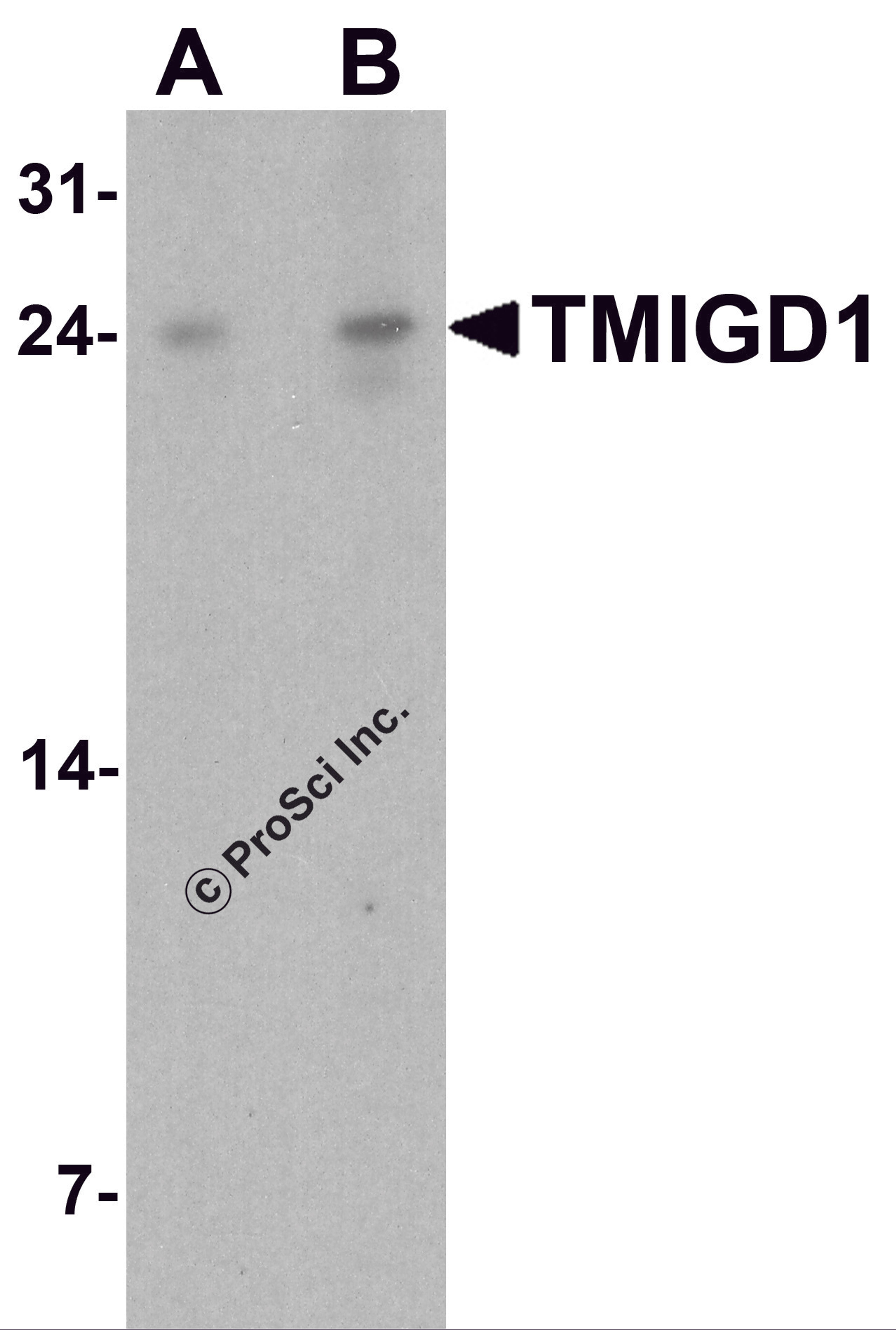 Western blot analysis of TMIGD1 in rat liver tissue lysate with TMIGD1 antibody at (A) 1 and (B) 2 μg/ml.