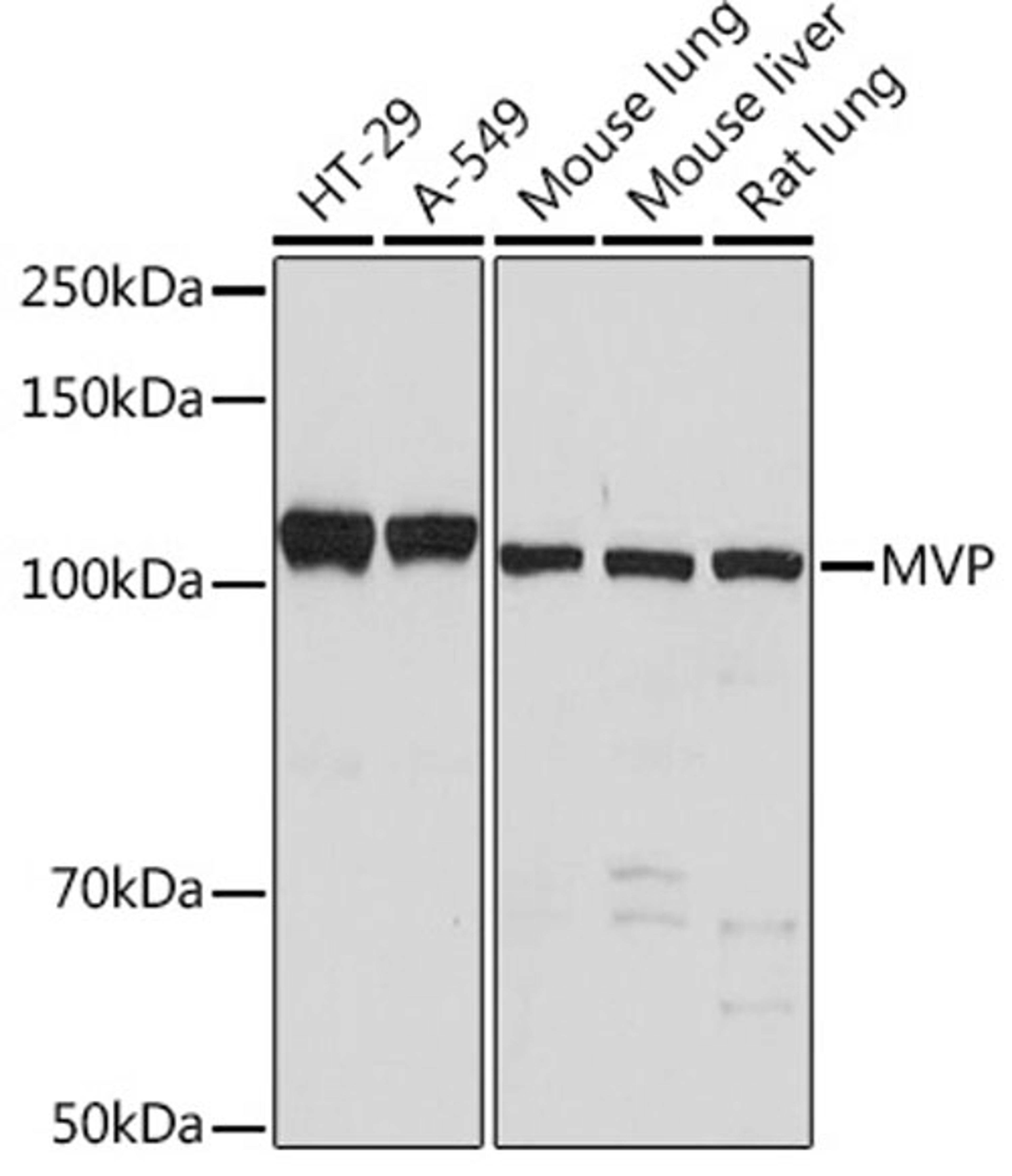 Western blot - MVP Rabbit mAb (A1039)