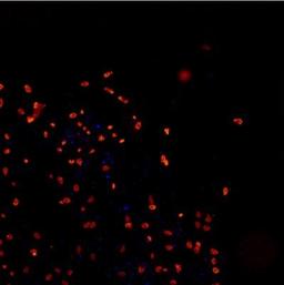 Immunocytochemistry/Immunofluorescence: TDP-43/TARDBP Antibody [NB110-55376] - Analysis using the DyLight 550 conjugate of NB110-55376. Staining of Human iPS derived neurons, fixed in 4% formaldehyde solution. The NB110-55376R was diluted 1:200. All antibodies were diluted in PBS/BSA 3% (w/v) ) Triton X-100 0,3 % (v/v). Images taken by an Arrayscan (Cellomics). Blue dots in TDP staining is Hoechst.