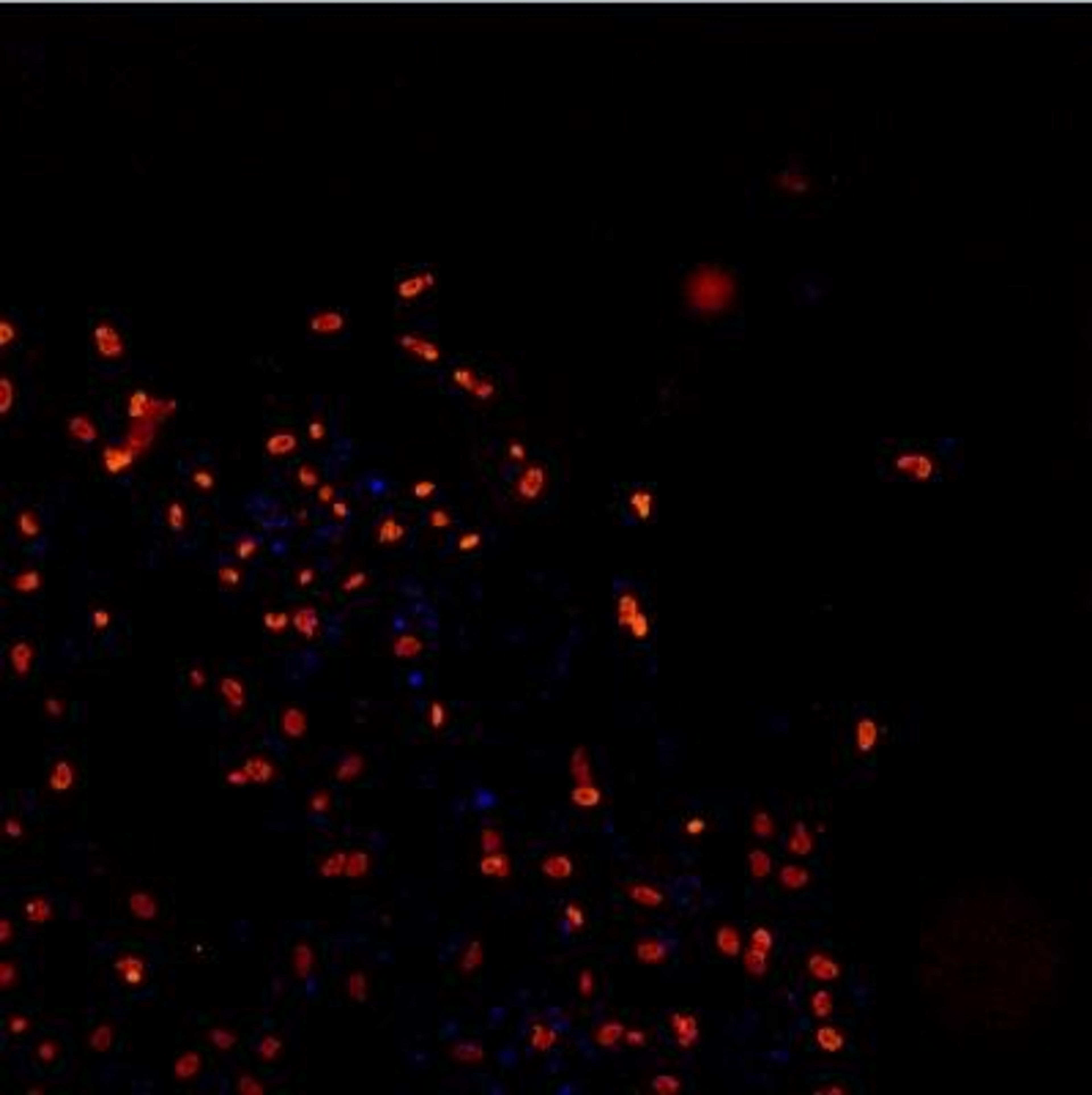 Immunocytochemistry/Immunofluorescence: TDP-43/TARDBP Antibody [NB110-55376] - Analysis using the DyLight 550 conjugate of NB110-55376. Staining of Human iPS derived neurons, fixed in 4% formaldehyde solution. The NB110-55376R was diluted 1:200. All antibodies were diluted in PBS/BSA 3% (w/v) ) Triton X-100 0,3 % (v/v). Images taken by an Arrayscan (Cellomics). Blue dots in TDP staining is Hoechst.