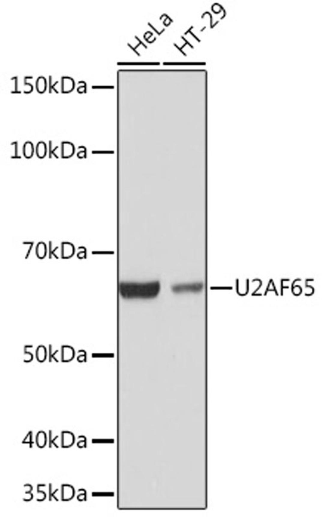 Western blot - U2AF65 Rabbit mAb (A4552)