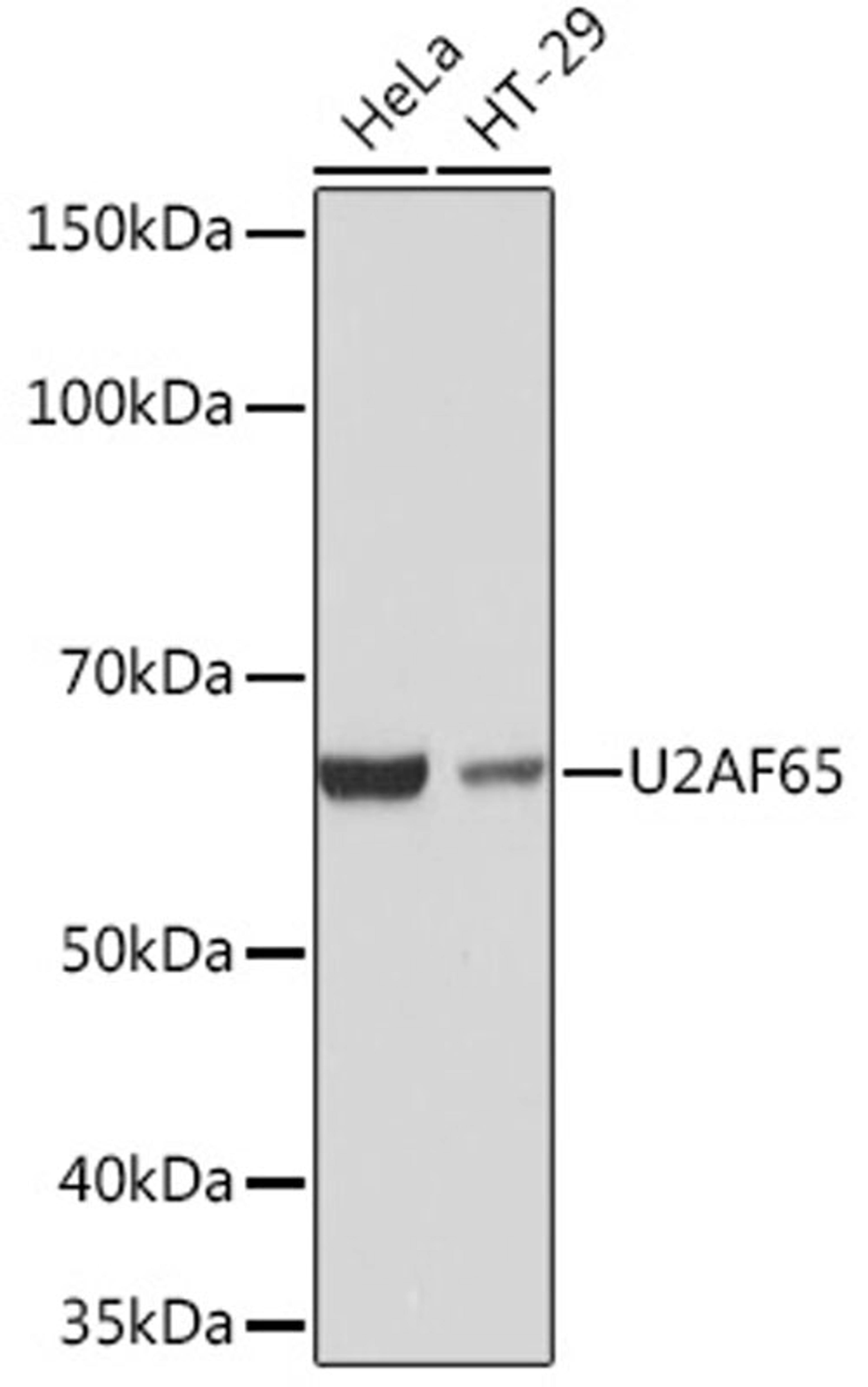 Western blot - U2AF65 Rabbit mAb (A4552)