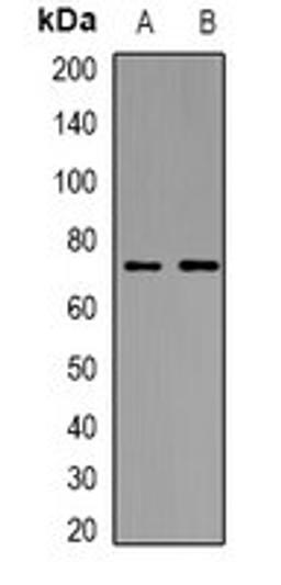 Western blot analysis of HeLa (Lane1), HEK293T (Lane2) whole cell lysates using ICK antibody