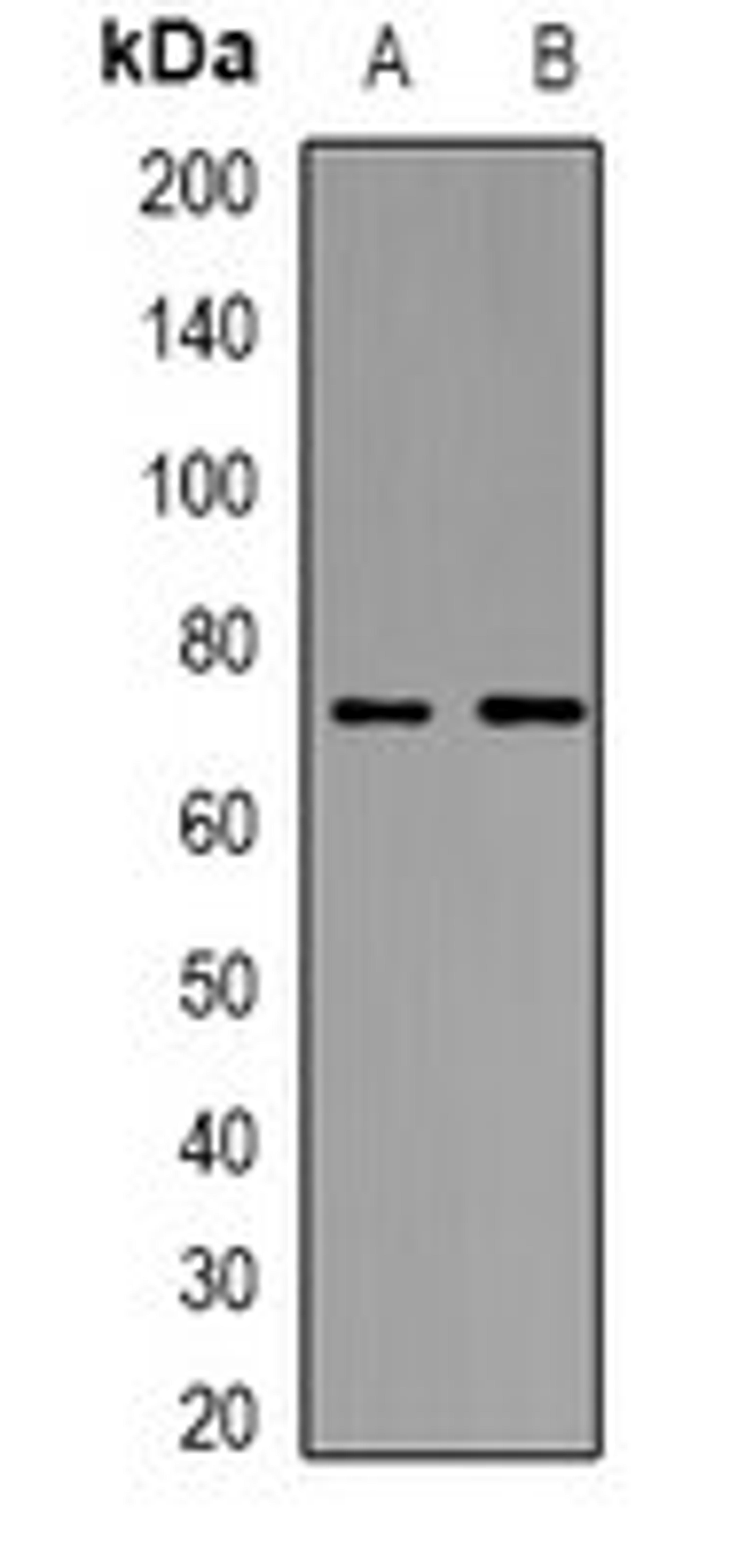 Western blot analysis of HeLa (Lane1), HEK293T (Lane2) whole cell lysates using ICK antibody