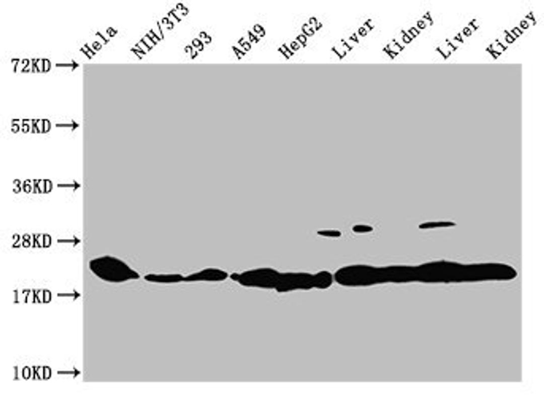 Western Blot. Positive WB detected in: Hela whole cell lysate, NIH/3T3 whole cell lysate, 293 whole cell lysate, A549 whole cell lysate, HepG2 whole cell lysate, Rat liver tissue, Rat kidney tissue, Mouse liver tissue, Mouse kidney tissue. All lanes: HIST1H1C antibody at 1:100. Secondary. Goat polyclonal to rabbit IgG at 1/50000 dilution. Predicted band size: 22 kDa. Observed band size: 22 kDa
