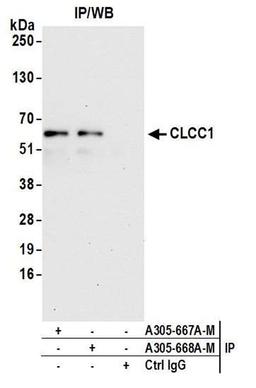 Detection of human CLCC1 by WB of IP.