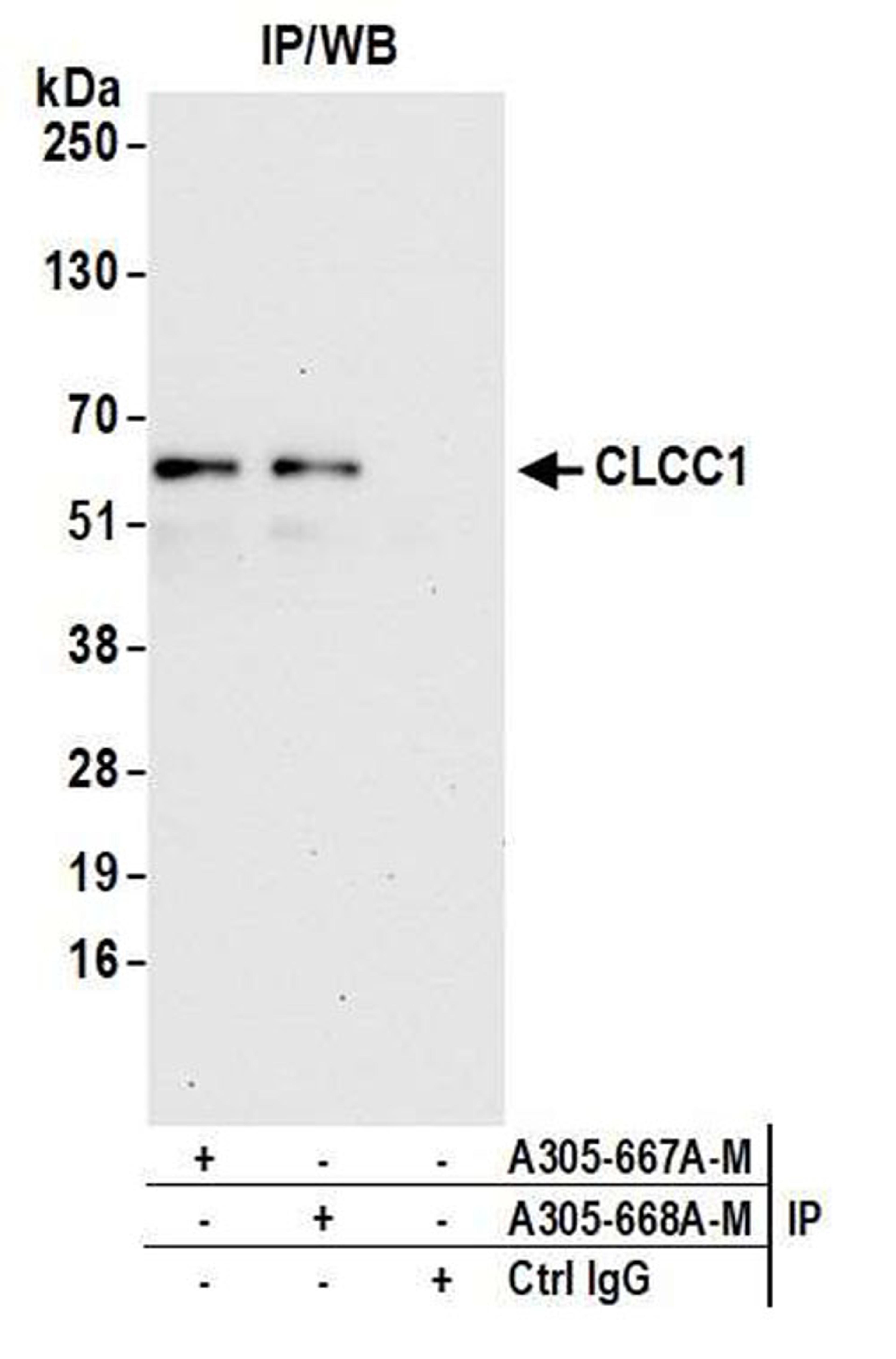 Detection of human CLCC1 by WB of IP.