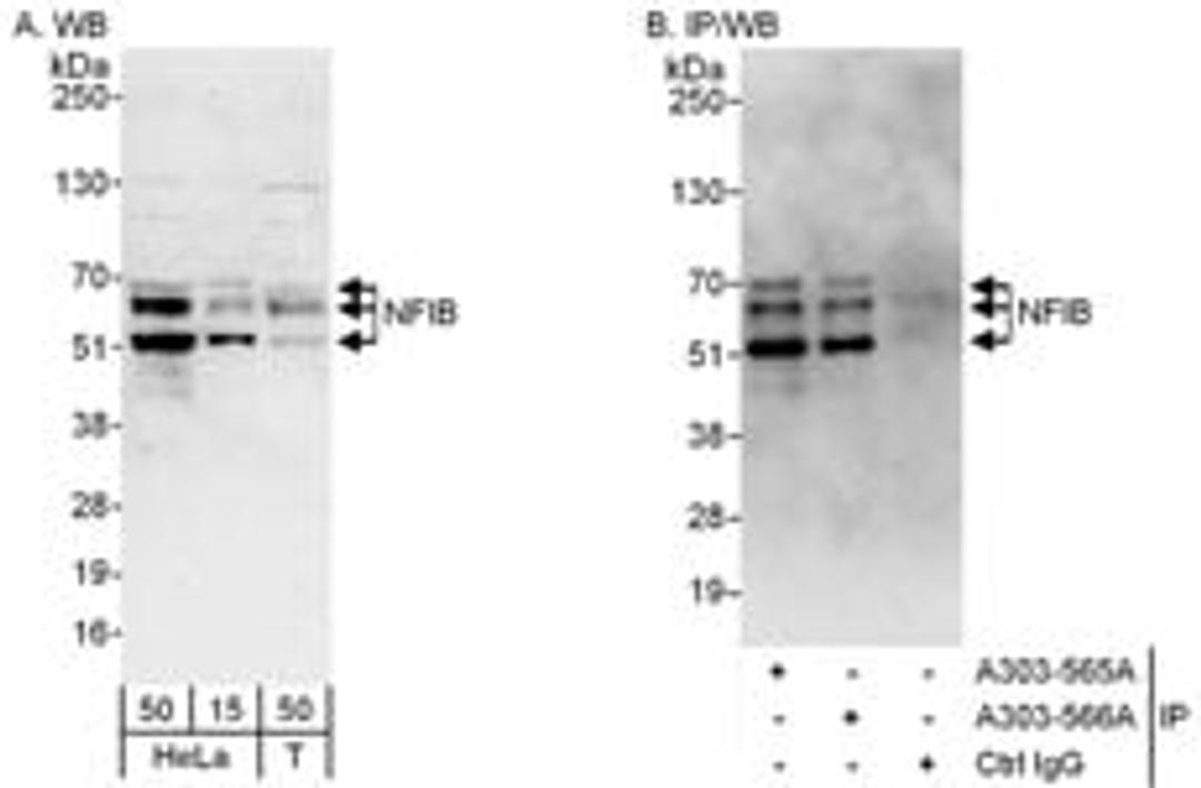 Detection of human NFIB by western blot and immunoprecipitation.